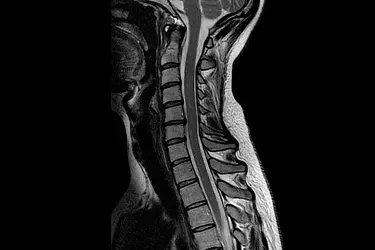 Best MRI Centre in Bhagalpur, 1.5 Tesla MRI in Bhagalpur, 3 Tesla MRI in Bhagalpur, Lowest cost of MRI in Bhagalpur, Breast MRI in Bhagalpur, MR Angiography Test in Bhagalpur, MR Spectroscopy in Bhagalpur, MRI Brain in Bhagalpur, MRI Knee Joint in Bhagalpur, MRI Spine in Bhagalpur, MRI Neck Vessels in Bhagalpur, best diagnostic centre in Bhagalpur, MRI Abdomen in Bhagalpur, MRI Chest in Bhagalpur, Contrast MRI in Bhagalpur