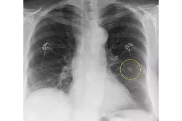 best hospital for digital x-ray test in bhagalpur, best doctor for digital x-ray test in bhagalpur, cost of digital x-ray test in bhagalpur